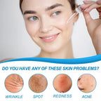 B5 Hyaluronic Acid Serum Facial anti A-Ging W-Rinkle Lift Firming Fine Lines Lightening Dark Circle Skin Brightening Hyalu Serum